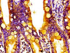 RGS1 Antibody - Immunohistochemistry image of paraffin-embedded human small intestine tissue at a dilution of 1:100