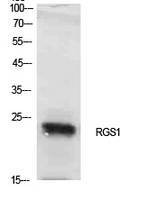 RGS1 Antibody - Western Blot analysis of extracts from NIH-3T3 cells using RGS1 Antibody.