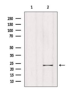 RGS1 Antibody - Western blot analysis of extracts of HeLa cells using RGS1 antibody. Lane 1 was treated with the antigen-specific peptide.