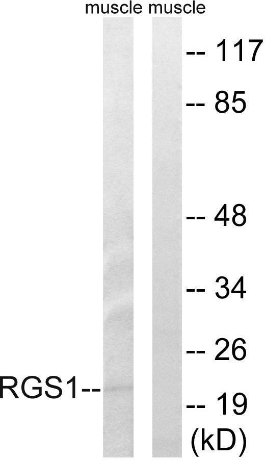 RGS1 Antibody - Western blot analysis of extracts from mouse muscle cells, using RGS1 antibody.