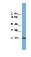 RGS1 Antibody - RGS1 antibody Western blot of Mouse Uterus lysate. This image was taken for the unconjugated form of this product. Other forms have not been tested.