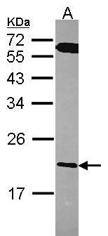 RGS10 Antibody - Sample (30 ug of whole cell lysate). A: A431 . 12% SDS PAGE. RGS10 antibody diluted at 1:1000.