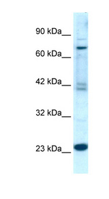 RGS10 Antibody - RGS10 antibody Western blot of Jurkat lysate. This image was taken for the unconjugated form of this product. Other forms have not been tested.