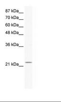 RGS10 Antibody - Jurkat Cell Lysate.  This image was taken for the unconjugated form of this product. Other forms have not been tested.