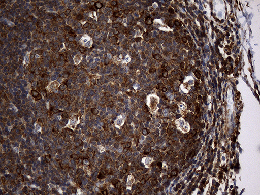 RGS10 Antibody - Immunohistochemical staining of paraffin-embedded Human tonsil within the normal limits using anti-RGS10 mouse monoclonal antibody. (Heat-induced epitope retrieval by 1mM EDTA in 10mM Tris buffer. (pH8.5) at 120°C for 3 min. (1:2000)