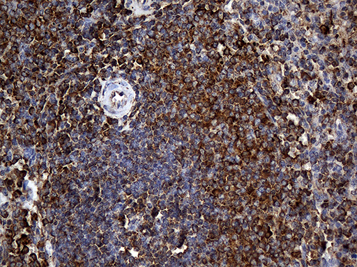 RGS10 Antibody - Immunohistochemical staining of paraffin-embedded Human spleen tissue within the normal limits using anti-RGS10 mouse monoclonal antibody. (Heat-induced epitope retrieval by 1mM EDTA in 10mM Tris buffer. (pH8.5) at 120°C for 3 min. (1:2000)