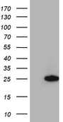 RGS10 Antibody - HEK293T cells were transfected with the pCMV6-ENTRY control. (Left lane) or pCMV6-ENTRY RGS10. (Right lane) cDNA for 48 hrs and lysed