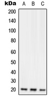 RGS10 Antibody - Western blot analysis of RGS10 expression in Jurkat (A); Raw264.7 (B); H9C2 (C) whole cell lysates.