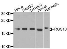 RGS10 Antibody - Western blot analysis of extracts of various cells.