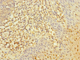 RGS10 Antibody - Immunohistochemistry of paraffin-embedded human tonsil tissue at dilution 1:100