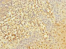 RGS10 Antibody - Immunohistochemistry of paraffin-embedded human tonsil tissue at dilution 1:100