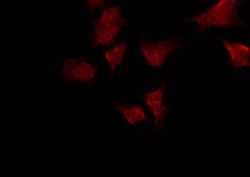 RGS10 Antibody - Staining HeLa cells by IF/ICC. The samples were fixed with PFA and permeabilized in 0.1% Triton X-100, then blocked in 10% serum for 45 min at 25°C. The primary antibody was diluted at 1:200 and incubated with the sample for 1 hour at 37°C. An Alexa Fluor 594 conjugated goat anti-rabbit IgG (H+L) Ab, diluted at 1/600, was used as the secondary antibody.