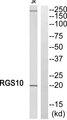 RGS10 Antibody - Western blot analysis of extracts from Jurkat cells, using RGS10 antibody.