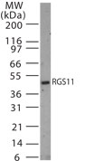 RGS11 Antibody - Western blot of RGS11 in 30 ugs of rat brain tissue lysate using antibody at 1:1000 dilution.