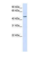 RGS11 Antibody - RGS11 antibody Western blot of 293T Cell lysate. Antibody concentration 1 ug/ml. This image was taken for the unconjugated form of this product. Other forms have not been tested.
