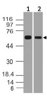 RGS11 Antibody - Fig-1: Western blot analysis of h RGS11. Anti-h RGS11 antibody was used at 1 µg/ml on (1) U87 and (2) T98G lysates.