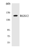RGS12 Antibody - Western blot analysis of the lysates from HUVECcells using RGS12 antibody.