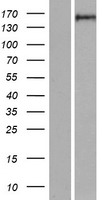 RGS12 Protein - Western validation with an anti-DDK antibody * L: Control HEK293 lysate R: Over-expression lysate