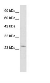 RGS13 Antibody - Daudi Cell Lysate.  This image was taken for the unconjugated form of this product. Other forms have not been tested.