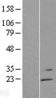 RGS13 Protein - Western validation with an anti-DDK antibody * L: Control HEK293 lysate R: Over-expression lysate
