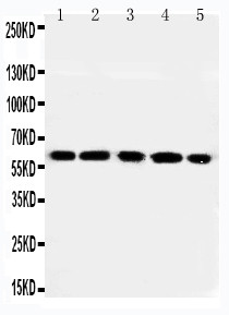 RGS14 Antibody - WB of RGS14 antibody. Lane 1: Rat Thymus Tissue Lysate. Lane 2: Rat Spleen Tissue Lysate. Lane 3: RAJI Cell Lysate. Lane 4: CEM Cell Lysate. Lane 5: JURKAT Cell Lysate.