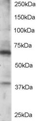 RGS14 Antibody - Antibody staining (0.5 ug/ml) of Jurkat lysate (RIPA buffer, 35 ug total protein per lane). Primary incubated for 1 hour. Detected by Western blot of chemiluminescence.
