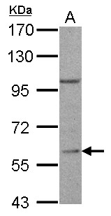 RGS14 Antibody - RGS14 antibody [C3], C-term detects RGS14 protein by Western blot analysis. A. 30 ug Jurkat whole lysate/extract. 7.5 % SDS-PAGE. RGS14 antibody [C3], C-term dilution:1:500