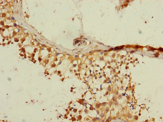 RGS14 Antibody - Immunohistochemistry of paraffin-embedded human testis tissue at dilution 1:100