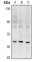 RGS14 Antibody - Western blot analysis of RGS14 expression in LOVO (A), BV2 (B), PC12 (C) whole cell lysates.