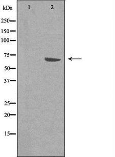 RGS14 Antibody - Western blot analysis of extracts of NIH-3T3 cells using RGS14 antibody. The lane on the left is treated with the antigen-specific peptide.