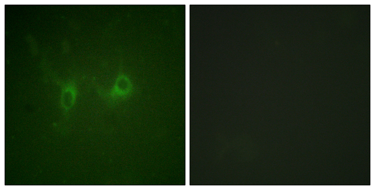 RGS16 Antibody - Immunofluorescence analysis of COS7 cells, using RGS16 Antibody. The picture on the right is blocked with the synthesized peptide.