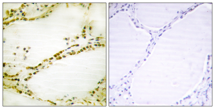 RGS16 Antibody - Immunohistochemistry analysis of paraffin-embedded human thyroid gland tissue, using RGS16 Antibody. The picture on the right is blocked with the synthesized peptide.