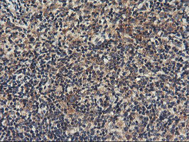 RGS16 Antibody - IHC of paraffin-embedded Human lymphoma tissue using anti-RGS16 mouse monoclonal antibody. (Heat-induced epitope retrieval by 10mM citric buffer, pH6.0, 100C for 10min).