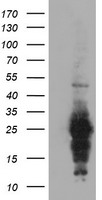 RGS16 Antibody - HEK293T cells were transfected with the pCMV6-ENTRY control (Left lane) or pCMV6-ENTRY RGS16 (Right lane) cDNA for 48 hrs and lysed. Equivalent amounts of cell lysates (5 ug per lane) were separated by SDS-PAGE and immunoblotted with anti-RGS16.