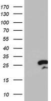 RGS16 Antibody - HEK293T cells were transfected with the pCMV6-ENTRY control (Left lane) or pCMV6-ENTRY RGS16 (Right lane) cDNA for 48 hrs and lysed. Equivalent amounts of cell lysates (5 ug per lane) were separated by SDS-PAGE and immunoblotted with anti-RGS16.