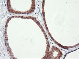 RGS16 Antibody - IHC of paraffin-embedded Human breast tissue using anti-RGS16 mouse monoclonal antibody.