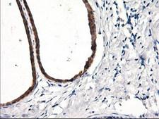 RGS16 Antibody - IHC of paraffin-embedded Human breast tissue using anti-RGS16 mouse monoclonal antibody. (Heat-induced epitope retrieval by 10mM citric buffer, pH6.0, 100C for 10min).