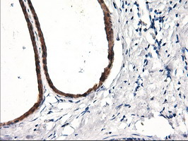 RGS16 Antibody - IHC of paraffin-embedded Human breast tissue using anti-RGS16 mouse monoclonal antibody. (Heat-induced epitope retrieval by 10mM citric buffer, pH6.0, 100C for 10min).