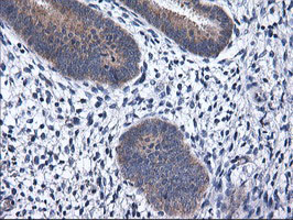 RGS16 Antibody - IHC of paraffin-embedded Human endometrium tissue using anti-RGS16 mouse monoclonal antibody. (Heat-induced epitope retrieval by 10mM citric buffer, pH6.0, 100C for 10min).