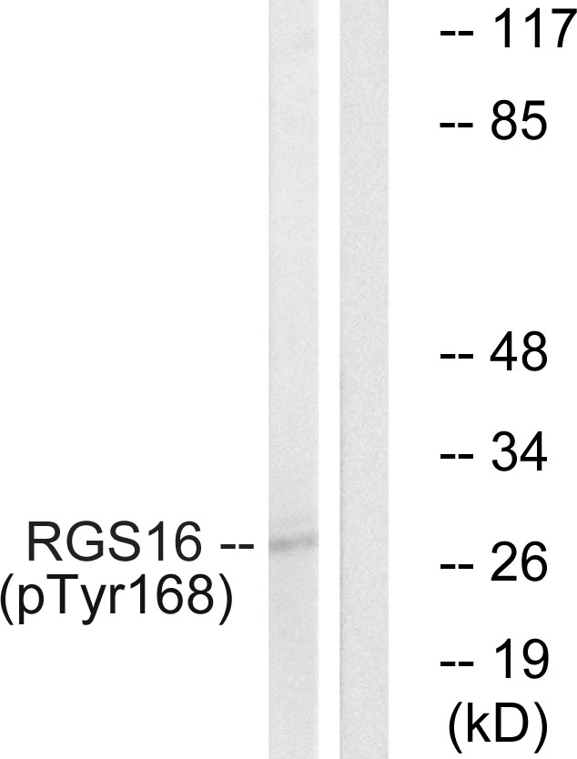 RGS16 Antibody - Western blot analysis of lysates from COS7 cells treated with heat shock, using RGS16 (Phospho-Tyr168) Antibody. The lane on the right is blocked with the phospho peptide.
