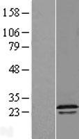 RGS16 Protein - Western validation with an anti-DDK antibody * L: Control HEK293 lysate R: Over-expression lysate