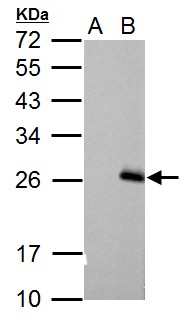 RGS17 / RGSZ2 Antibody - Sample (30 ug of whole cell lysate). A: Non-transfected 293T lysates, B: RGS17 transfected 293T lysates. 12% SDS PAGE. RGS17 / RGSZ2 antibody diluted at 1:5000.