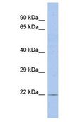 RGS17 / RGSZ2 Antibody - RGS17 / RGSZ2 antibody Western Blot of COLO205. Antibody dilution: 1 ug/ml.  This image was taken for the unconjugated form of this product. Other forms have not been tested.