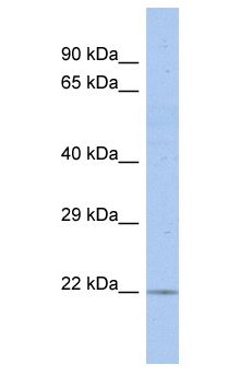 RGS17 / RGSZ2 Antibody - RGS17 / RGSZ2 antibody Western Blot of COLO205. Antibody dilution: 1 ug/ml.  This image was taken for the unconjugated form of this product. Other forms have not been tested.