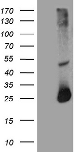 RGS17 / RGSZ2 Antibody - HEK293T cells were transfected with the pCMV6-ENTRY control. (Left lane) or pCMV6-ENTRY RGS17. (Right lane) cDNA for 48 hrs and lysed. Equivalent amounts of cell lysates. (5 ug per lane) were separated by SDS-PAGE and immunoblotted with anti-RGS17. (1:2000)