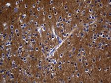 RGS17 / RGSZ2 Antibody - Immunohistochemical staining of paraffin-embedded Human adult brain tissue within the normal limits using anti-RGS17 mouse monoclonal antibody. (Heat-induced epitope retrieval by 1mM EDTA in 10mM Tris buffer. (pH8.5) at 120 oC for 3 min. (1:500)