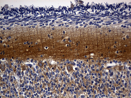 RGS17 / RGSZ2 Antibody - Immunohistochemical staining of paraffin-embedded Human embryonic cerebellum within the normal limits using anti-RGS17 mouse monoclonal antibody. (Heat-induced epitope retrieval by 1mM EDTA in 10mM Tris buffer. (pH8.5) at 120°C for 3 min. (1:500)