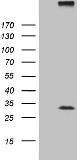 RGS17 / RGSZ2 Antibody - HEK293T cells were transfected with the pCMV6-ENTRY control. (Left lane) or pCMV6-ENTRY RGS17. (Right lane) cDNA for 48 hrs and lysed. Equivalent amounts of cell lysates. (5 ug per lane) were separated by SDS-PAGE and immunoblotted with anti-RGS17. (1:2000)