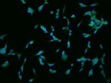 RGS17 / RGSZ2 Antibody - Immunofluorescence staining of RGS17 in SHSY5Y cells. Cells were fixed with 4% PFA, permeabilzed with 0.1% Triton X-100 in PBS, blocked with 10% serum, and incubated with rabbit anti-Human RGS17 polyclonal antibody (dilution ratio 1:200) at 4°C overnight. Then cells were stained with the Alexa Fluor 488-conjugated Goat Anti-rabbit IgG secondary antibody (green) and counterstained with DAPI (blue). Positive staining was localized to Cytoplasm.