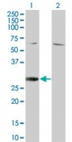 RGS18 Antibody - Western blot of RGS18 in 1) transfected 293T cells and 2) untransfected 293T cells using RGS18 Antibody at 1:500.